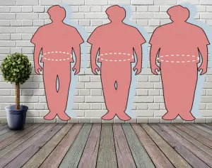 Obesity and VA claims